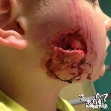 澳门开奖结果开奖记录表013和狗闯村民家咬伤女童与村里的狗咬人,应该找谁解决